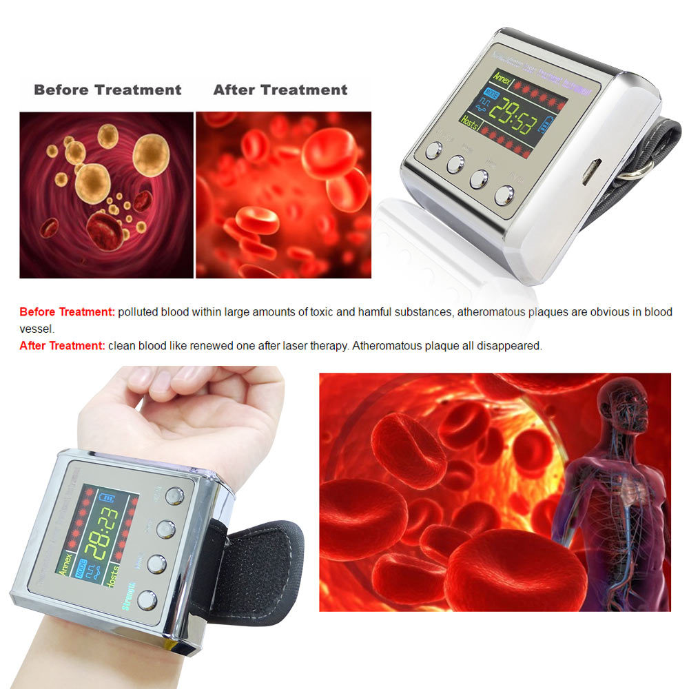 Does Laser Therapy Work for High Blood Pressure