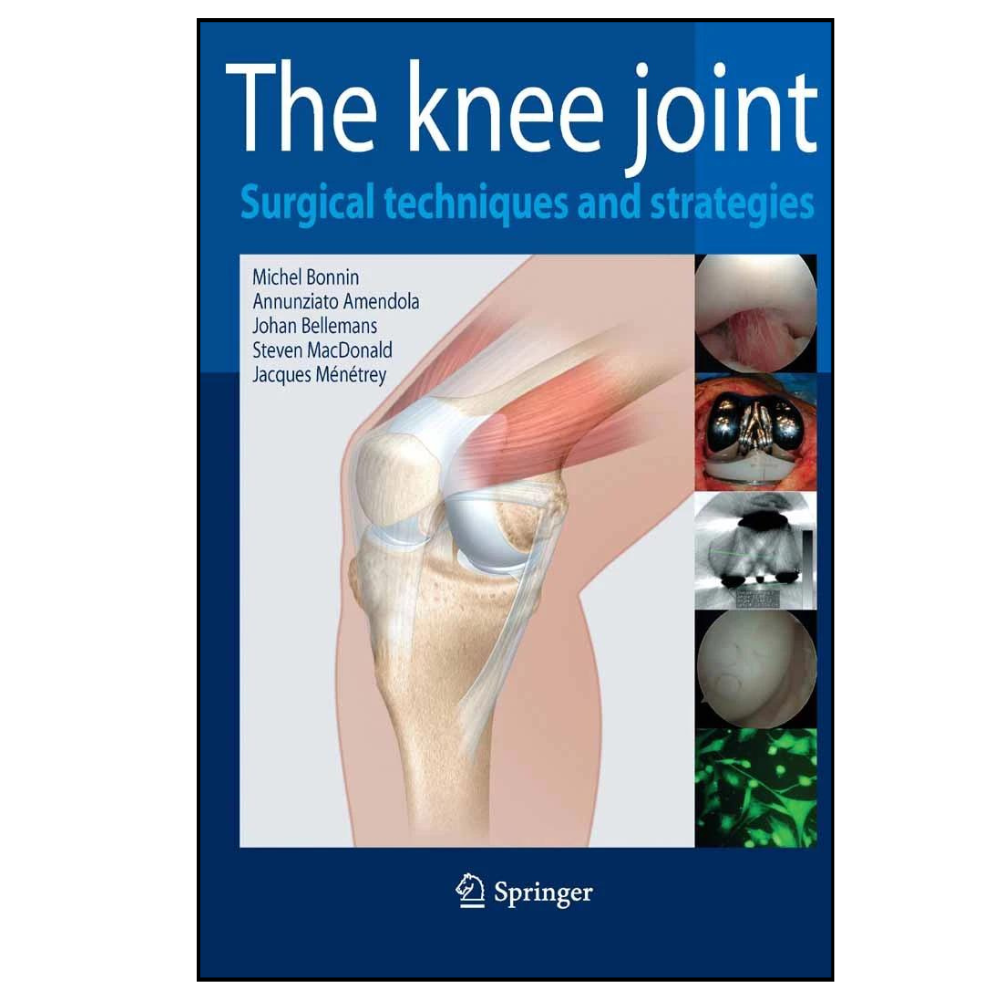 The Knee Joint: Surgical Techniques and Strategies ebook cover