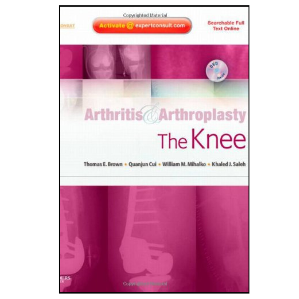 Arthritis and Arthroplasty: The Knee ebook cover